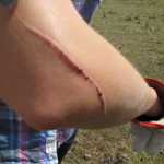 War wounds started early...the second PM to suffer a "significant project issue" - it will scar Vicky :) lol!